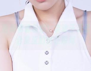 First Image