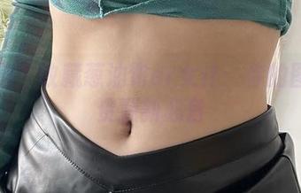 First Image